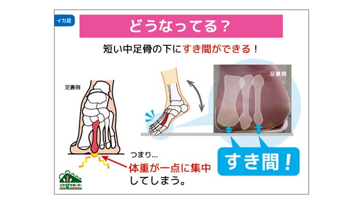 「イカ足」とは? 3