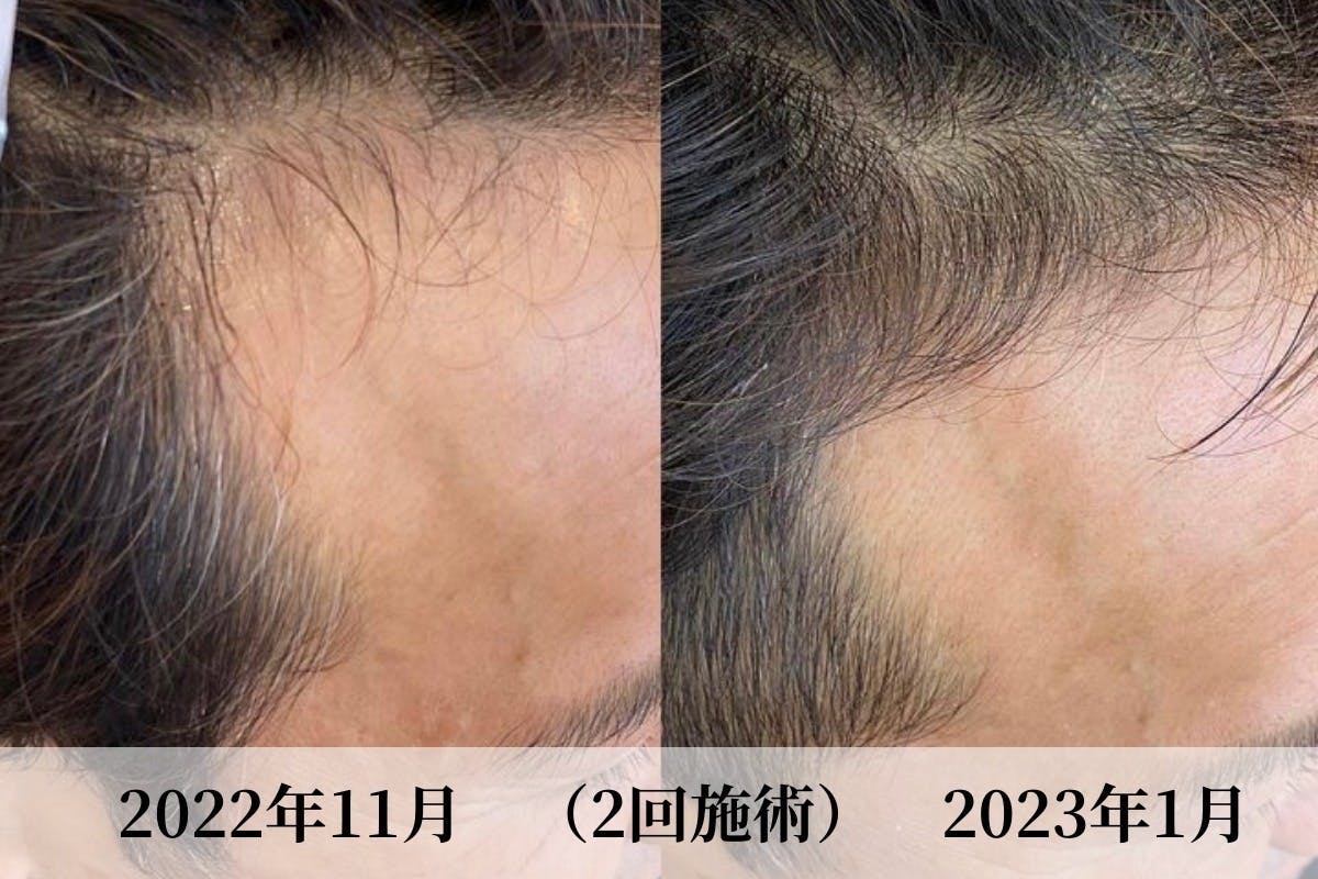 3番目のメイン画像