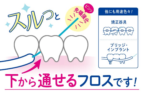 インプラント治療後にフロスの正しい使い方