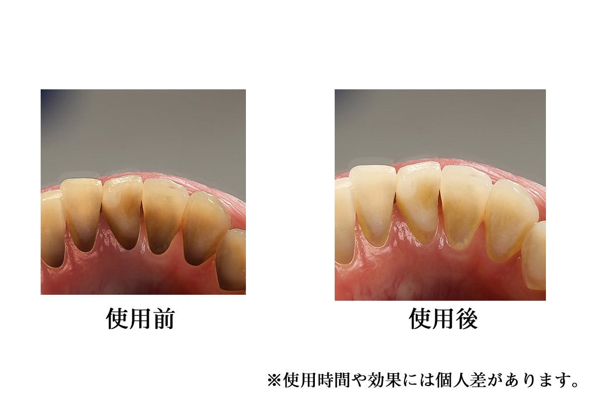 5番目のメイン画像