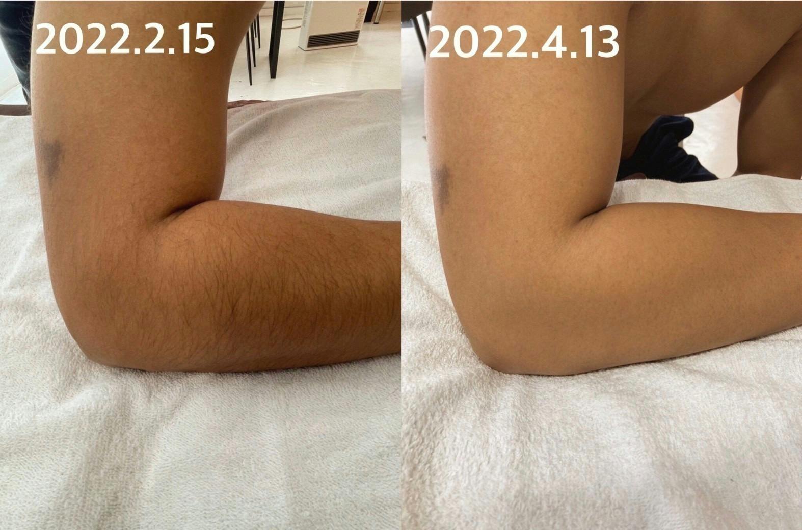 4番目のメイン画像